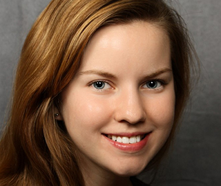 After portrait of bonding to correct a missing lateral incisor