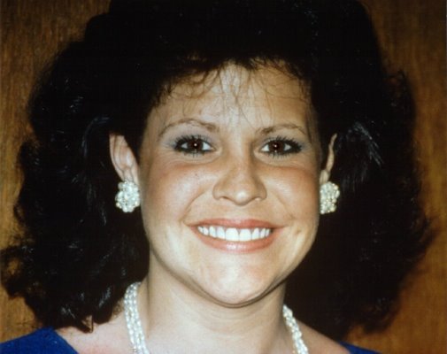 After Picture of Teeth Stained by the Antibiotic Tetracycline Whitened by Bonding