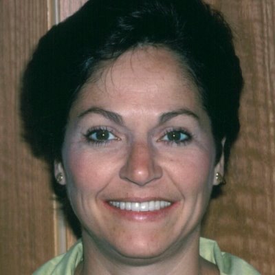 A happy patient shows off her beautiful smile after being restored with porcelain crowns