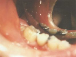 Mirror view of a Maryland bridge shows the metal wings used for bonding
