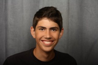 Overbite correction with retainer after portrait