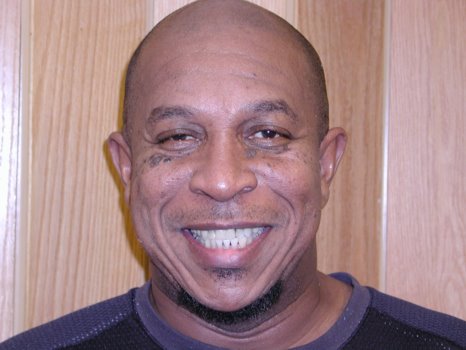 A happy patient with his new partial dentures