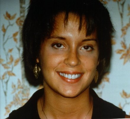 A happy patient smiling with tetracycline stained teeth covered with porcelain laminates