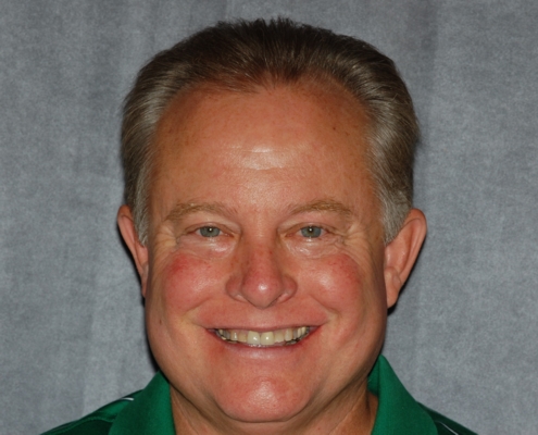 Smile With Worn Teeth Due to night Grinding